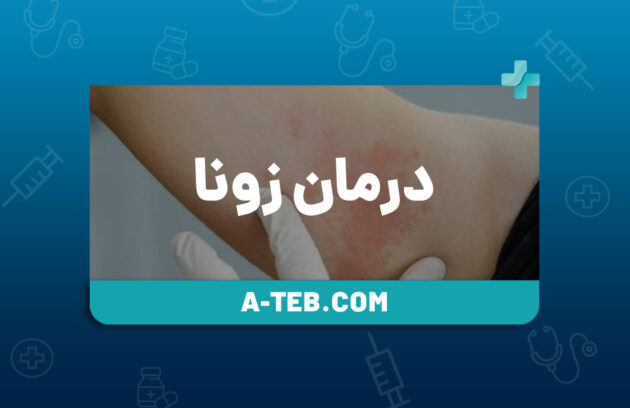 درمان زونا