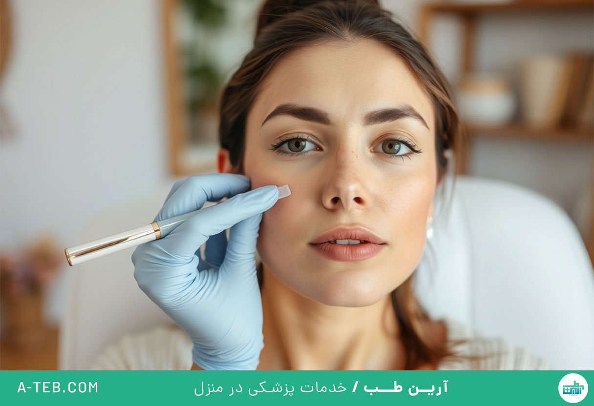 برداشتن خال در منزل