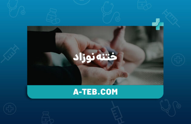 ختنه نوزاد