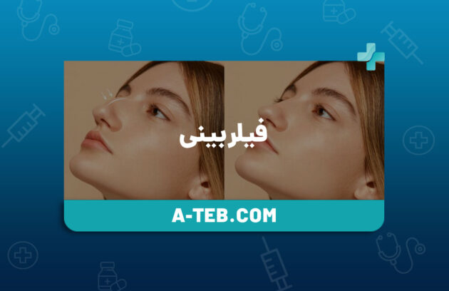 فیلر بینی در منزل تهران