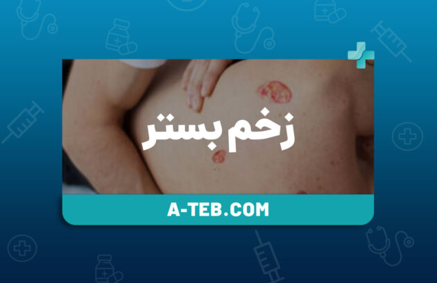 درمان زخم بستر در منزل