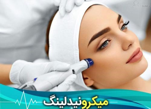 میکرونیدلینگ