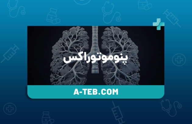 پنوموتوراکس