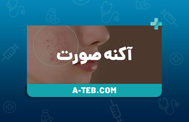 آکنه صورت