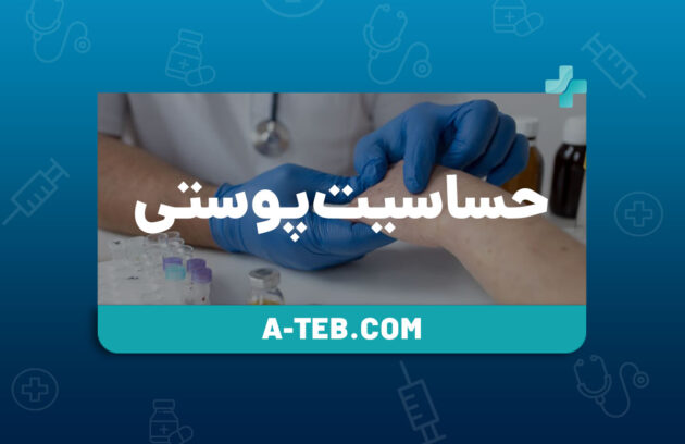 حساسیت پوستی