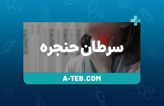 سرطان حنجره