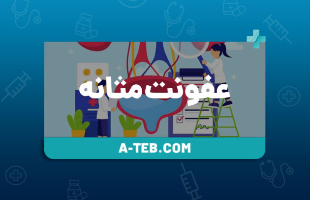 عفونت مثانه