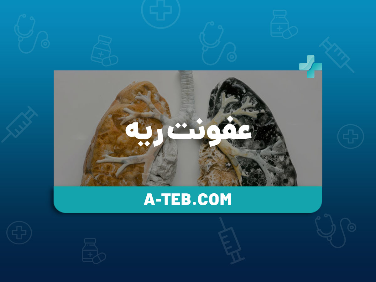 عفونت ریه