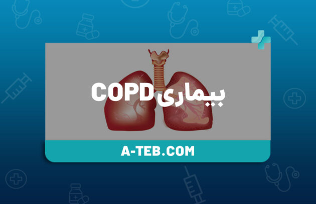 بیماری copd