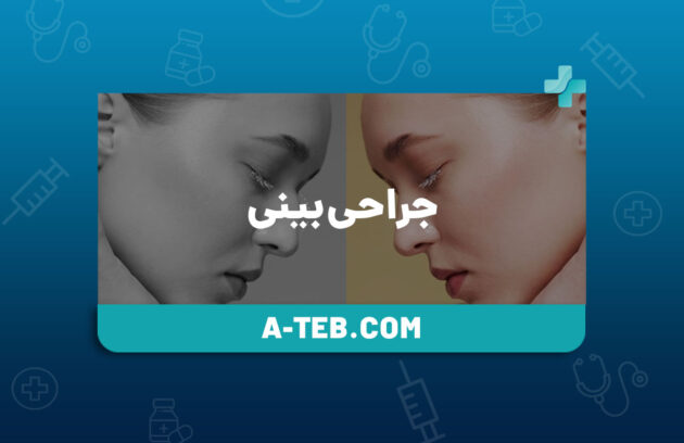 جراحی بینی