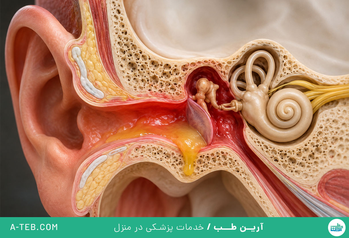 عفونت گوش