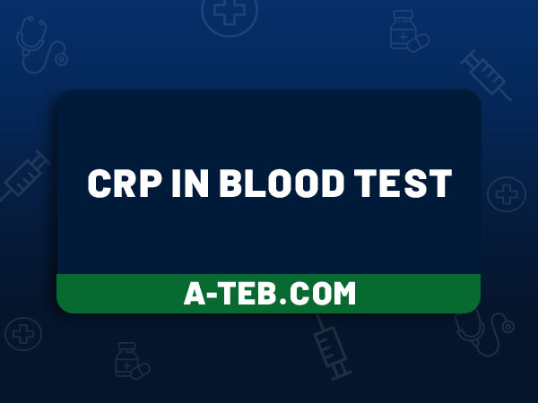 crp در آزمایش خون