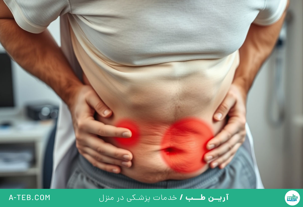 فتق