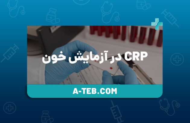 crp در آزمایش خون