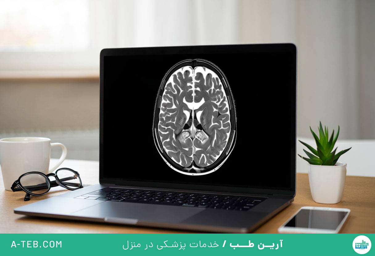 نوار مغز در منزل