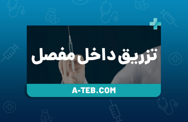 تزریق داخل مفصل