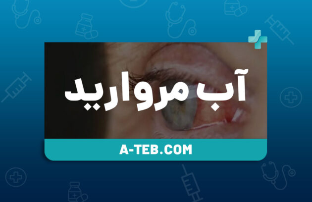 آب مروارید