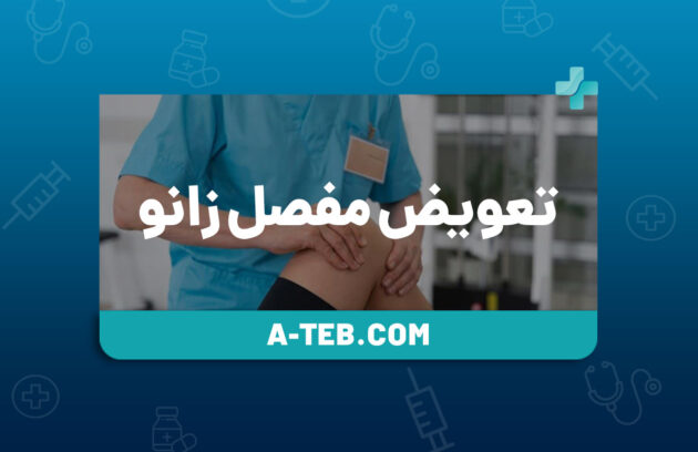 تعویض مفصل زانو