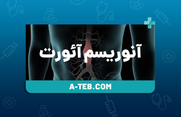 آنوریسم آئورت