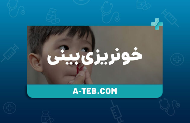 خونریزی بینی