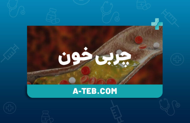 چربی خون