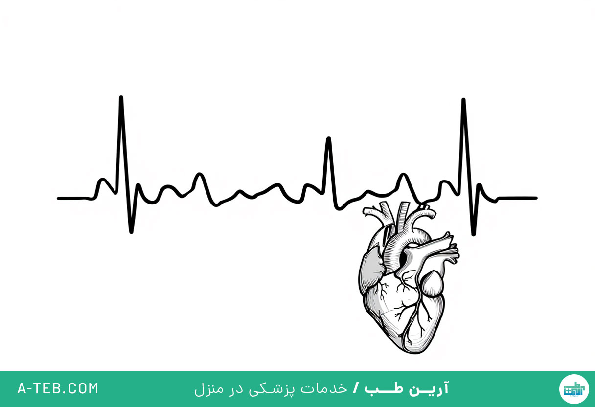 تاکی کاردی بطنی