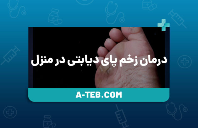 درمان زخم پای دیابتی در منزل