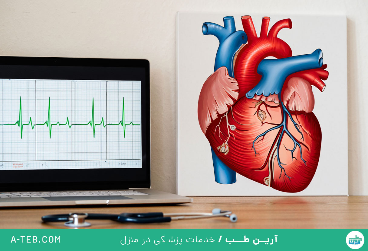 نوار قلب در منزل نیاوران