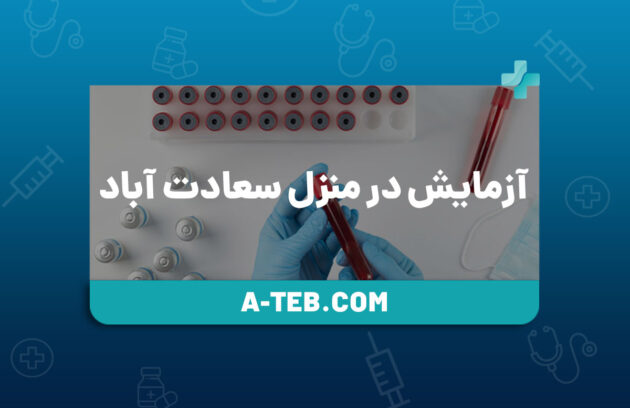 آزمایش در منزل سعادت آباد