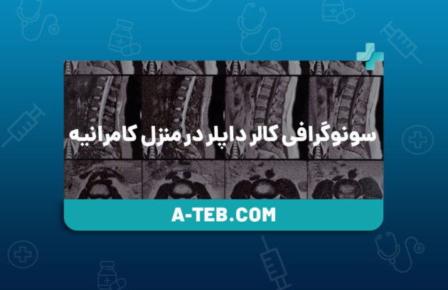 سونوگرافی کالر داپلر (رنگی) در منزل کامرانیه