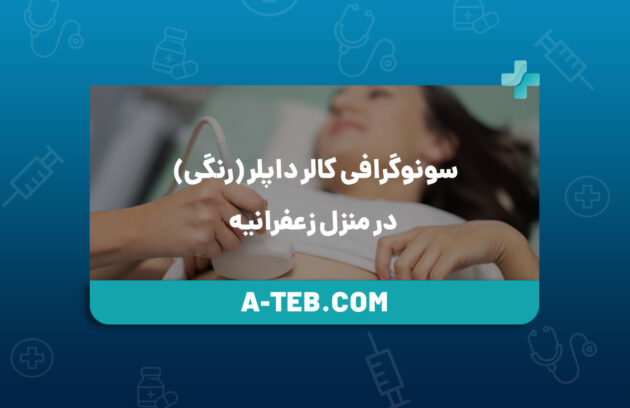 سونوگرافی کالر داپلر (رنگی) در منزل زعفرانیه
