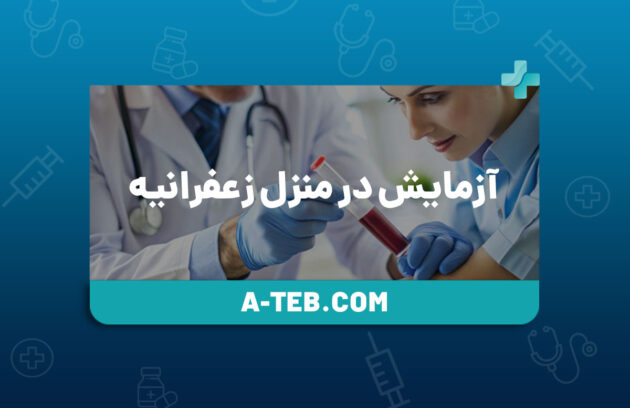 آزمایش در منزل زعفرانیه