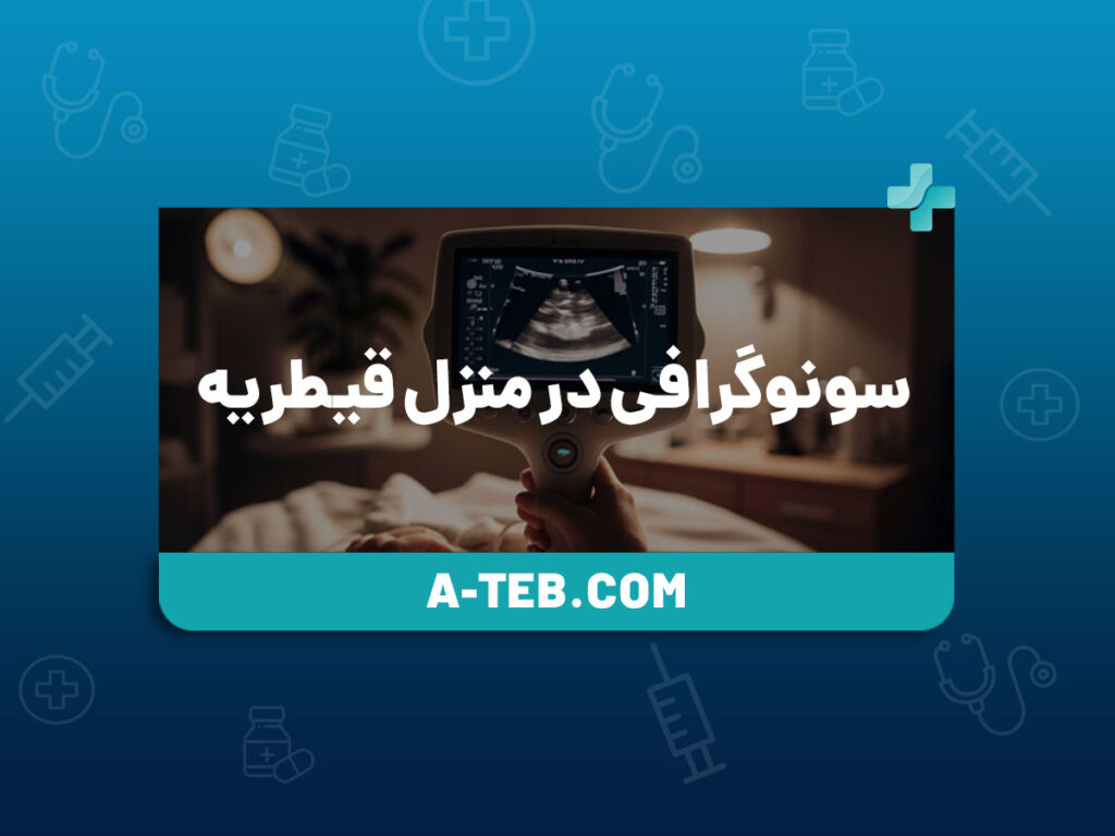 سونوگرافی-در-منزل-قیطریه