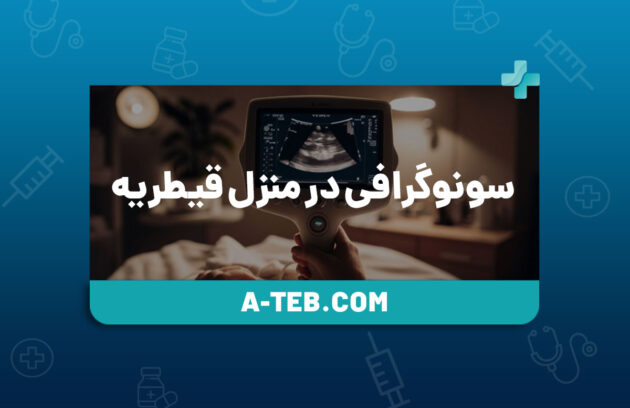 سونوگرافی-در-منزل-قیطریه