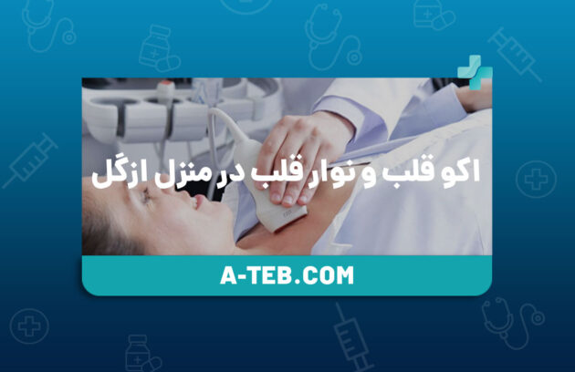 اکو قلب و نوار قلب در منزل ازگل