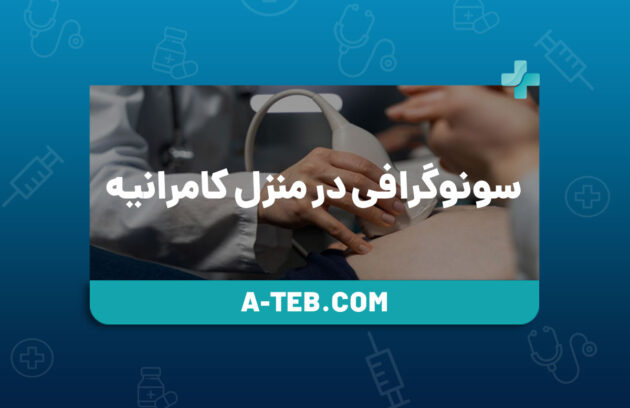 سونوگرافی در منزل کامرانیه