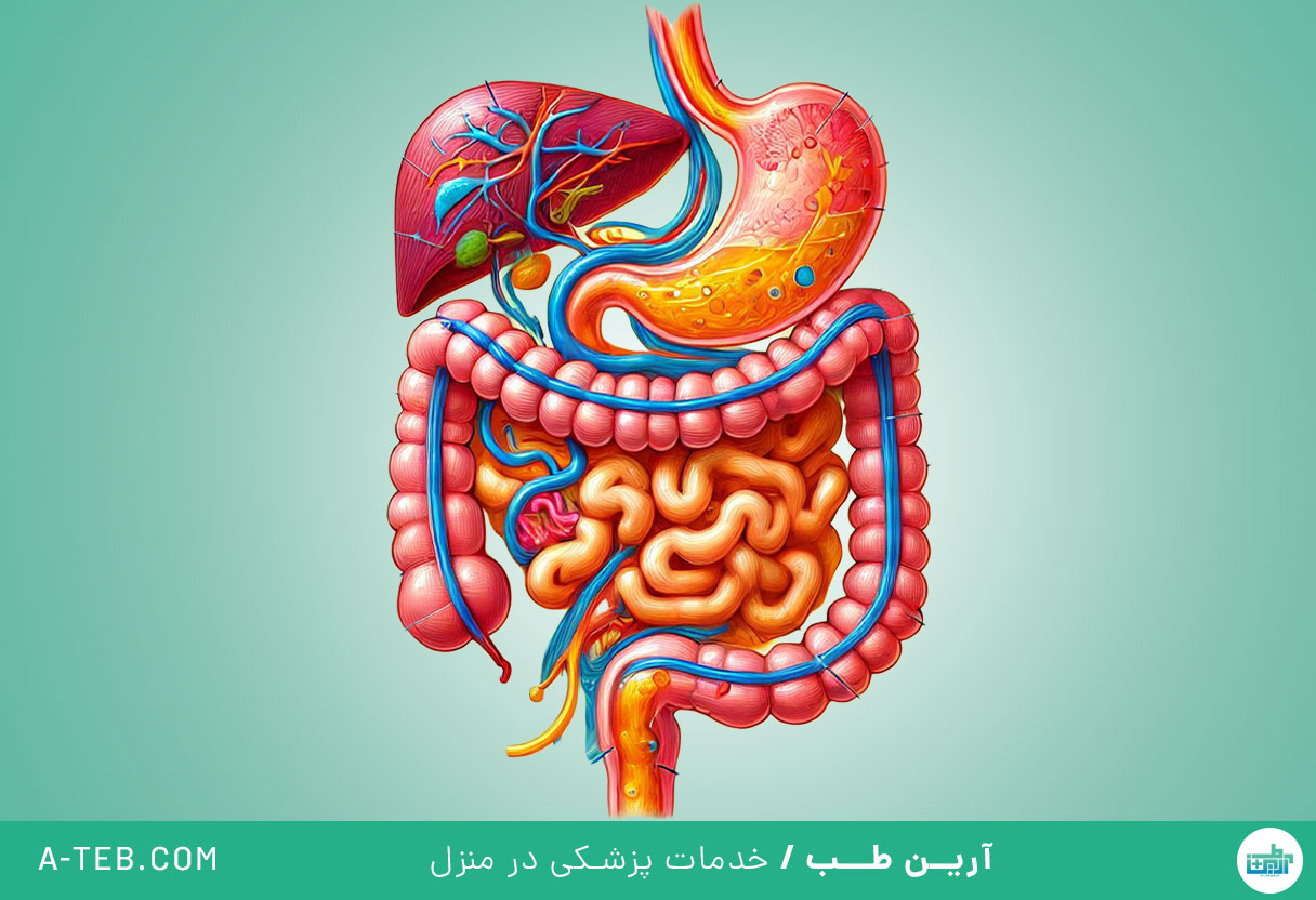 ریفلاکس صفراوی