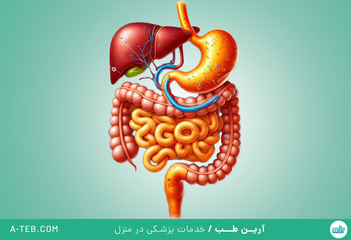 ریفلاکس صفراوی