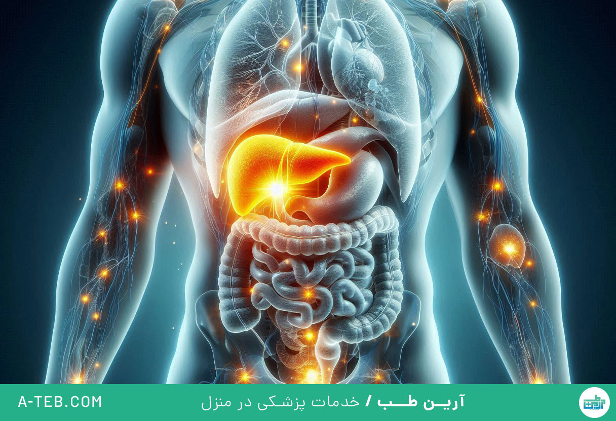 التهاب کیسه صفرا