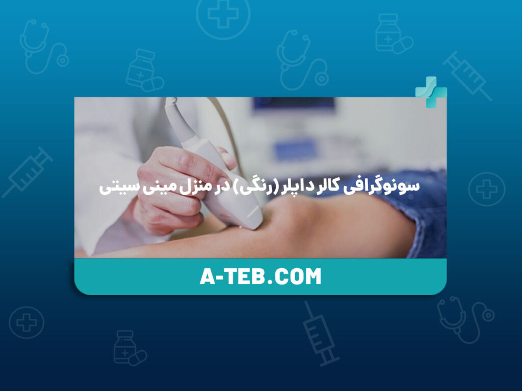 سونوگرافی کالر داپلر در منزل مینی سیتی