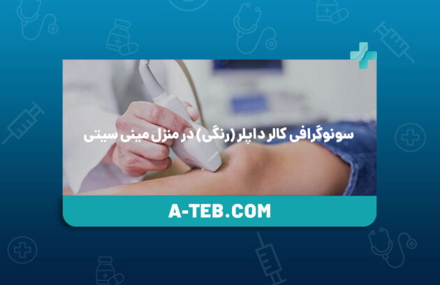 سونوگرافی کالر داپلر در منزل مینی سیتی