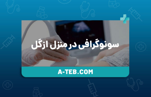 سونوگرافی در منزل ازگل