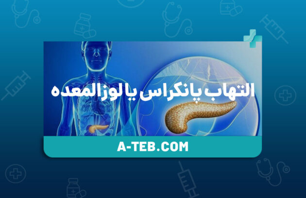 التهاب پانکراس یا لوزالمعده