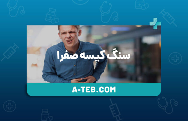 سنگ کیسه صفرا