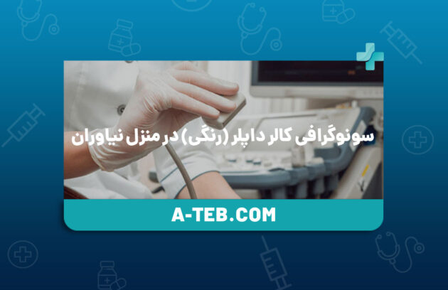 سونوگرافی کالر داپلر در منزل نیاوران