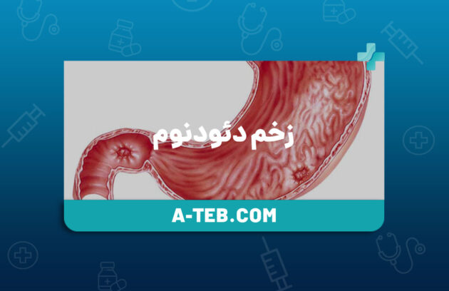 زخم دئودنوم