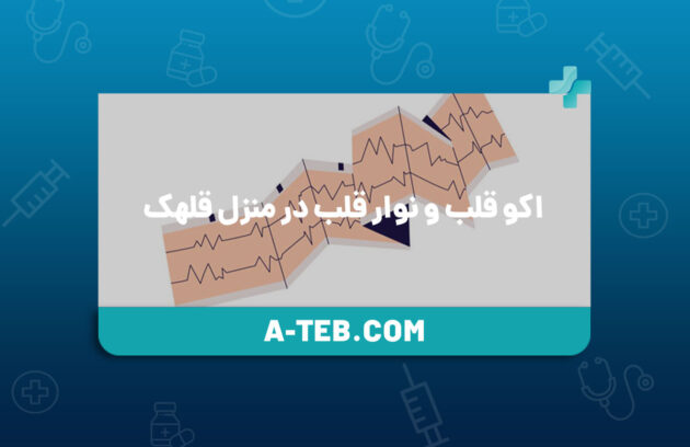 اکو قلب و نوار قلب در منزل قلهک