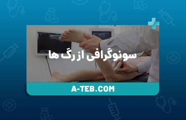 سونوگرافی از رگ ها