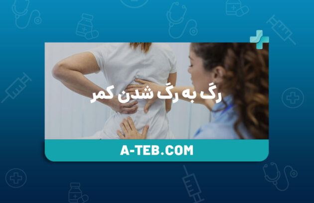 رگ‌ به رگ شدن کمر