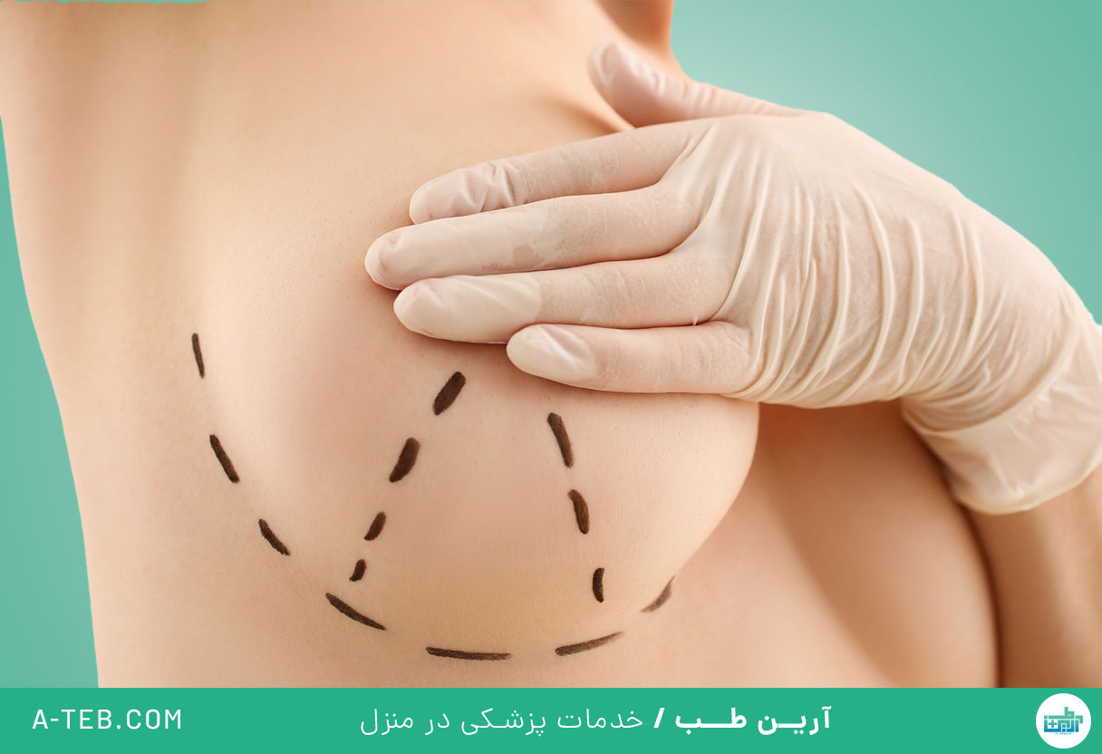 بزرگ کردن سینه